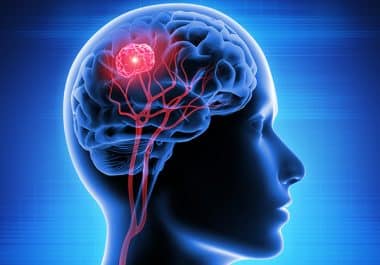 First Systemic Therapy for Pediatric BRAF-mutated Low-grade Glioma