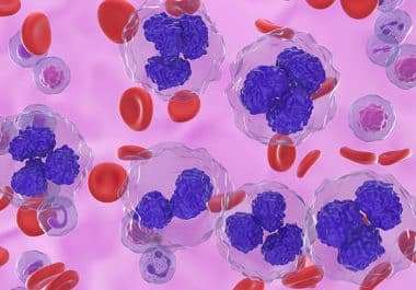 Lisocabtagene Maraleucel Approved for Follicular Cancer