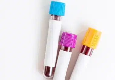 What Is Liquid Biopsy?