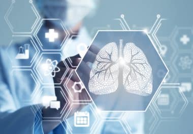 Immunotherapy Drug Tarlatamab Approved for Advanced Small Cell Lung Cancer