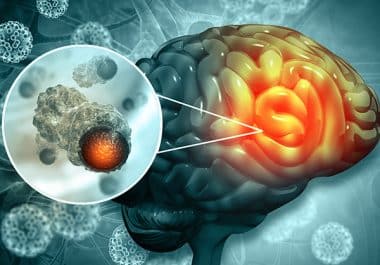First IDH Inhibitor for Astrocytomas and Oligodendrogliomas