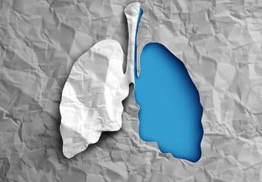 Durvalumab Approved in Combination with Chemotherapy for Early-stage Lung Cancer 