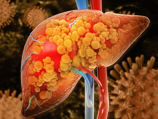 Feature-600x450_FDA-Approval-