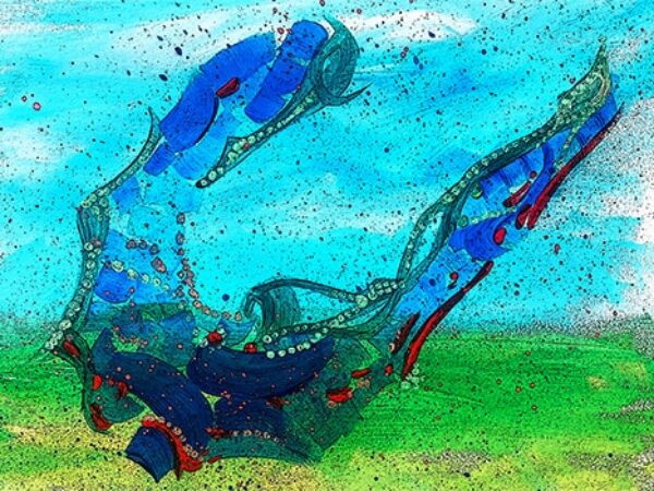 Editors’ Picks, June 2025: Intercepting Pancreatic Cancer, Predicting Breast Cancer, and More