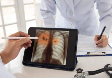 July 11: The Week in Cancer News