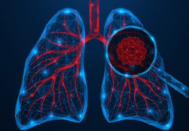New Targeted Therapy Approved for HER2-mutated Lung Cancers  