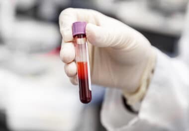 September 5: The Week in Cancer News