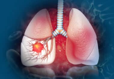 September 12: The Week in Cancer News