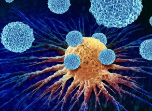 Boosting the Immune Response to Cancer