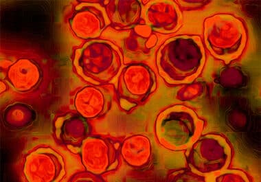 Editors’ Picks, September 2025: Cervical Cancer Screening, Immunotherapy Breakthroughs, Metabolic Vulnerabilities, and More 