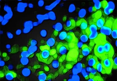 Editors’ Picks, October 2025: Drug Delivery Technology, Anticancer Effects of Alzheimer’s Protein, and More