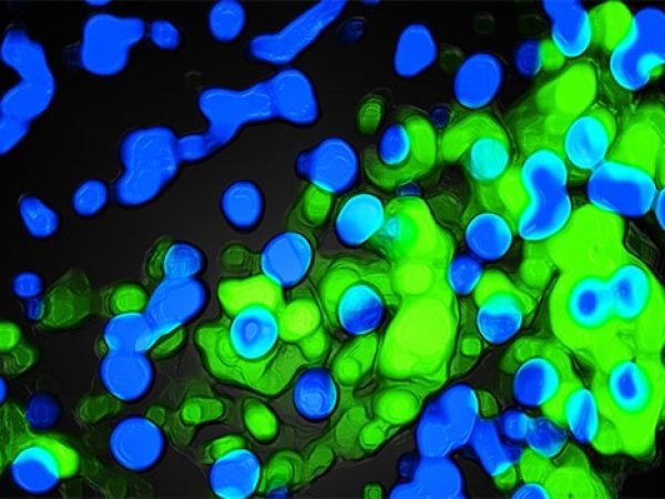 Editors’ Picks, October 2025: Drug Delivery Technology, Anticancer Effects of Alzheimer’s Protein, and More