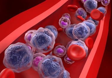 Revumenib Approved to Treat Certain Cases of Acute Myeloid Leukemias