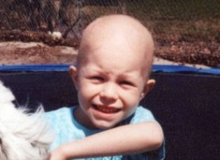30 Years After Childhood Cancer