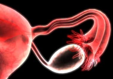 Psychology and Physiology: The Impact of Chronic Stress on Ovarian Cancer