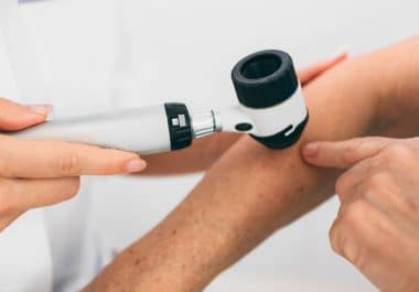 FDA Approves Immunotherapy for Cutaneous Squamous-cell Carcinoma