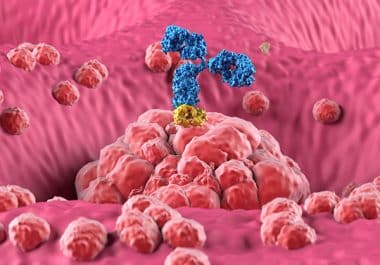 Immunotherapy Approved in Combination With Chemotherapy for Certain Gastric Cancers