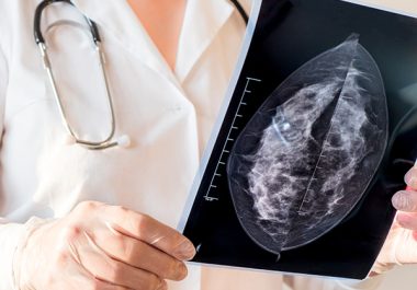 Circulating Tumor DNA Levels After Preliminary Therapy May Better Predict Breast Cancer