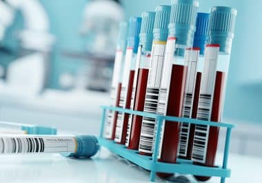 An Investigational Blood Test May Improve Detection of Pancreatic Cancer