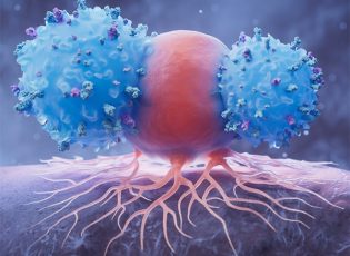 Genetic Ancestry and Prostate Cancer: Personalizing Early Detection and Treatment