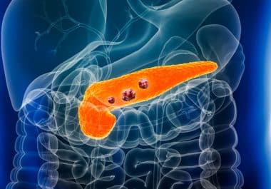 February 20: The Week in Cancer News