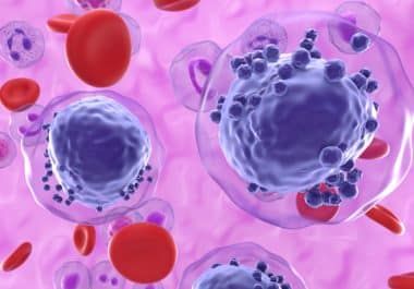 The Week in Cancer News: Treatment-related Blood Cancers and Lower Cancer Rates Among Married People