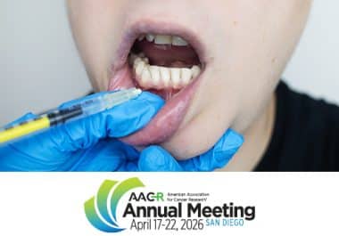 Intercepting Oral Cancer, Sparing Surgery, Preserving Quality of Life