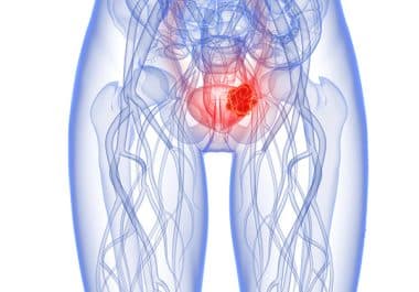 Intravenous or Subcutaneous Atezolizumab for Bladder Cancer After Surgery