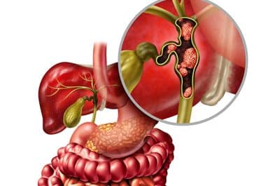 Targeted Therapy Zenocutuzumab Approved for Ultrarare Type of Bile Duct Cancer