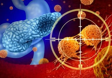 The Week in Cancer News: Pancreatic Cancer Drug Approval