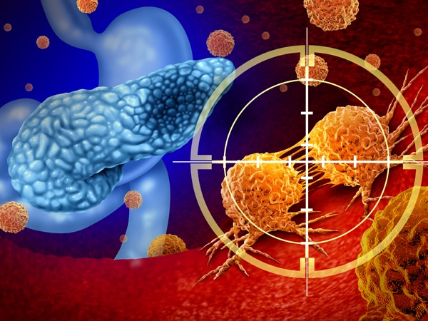 Progress Against Cancer