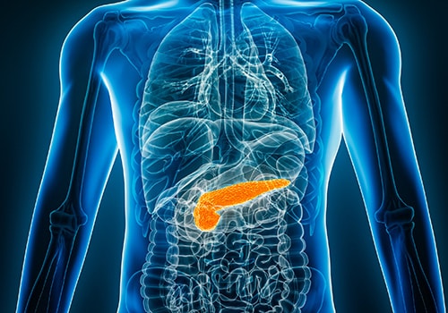 Breaking News: Daraxonrasib Approved for Pancreatic Cancer
