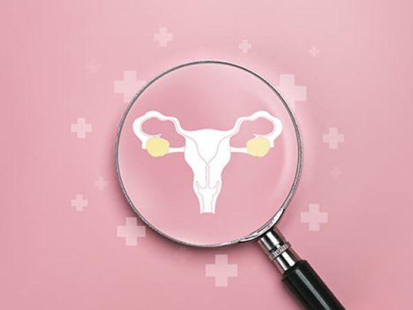 How New Science is Reshaping Ovarian Cancer Treatment and Care