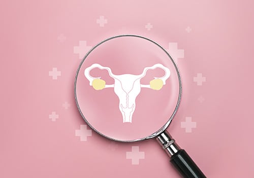 How New Science is Reshaping Ovarian Cancer Treatment and Care