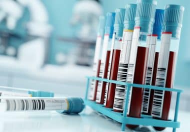 The Week in Cancer News: Multi-cancer Detection Blood Test