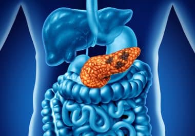 Targeted Therapy Improves Pancreatic Cancer Survival