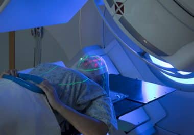 The Week in Cancer News: Splitting Radiation Doses for Brain Metastases